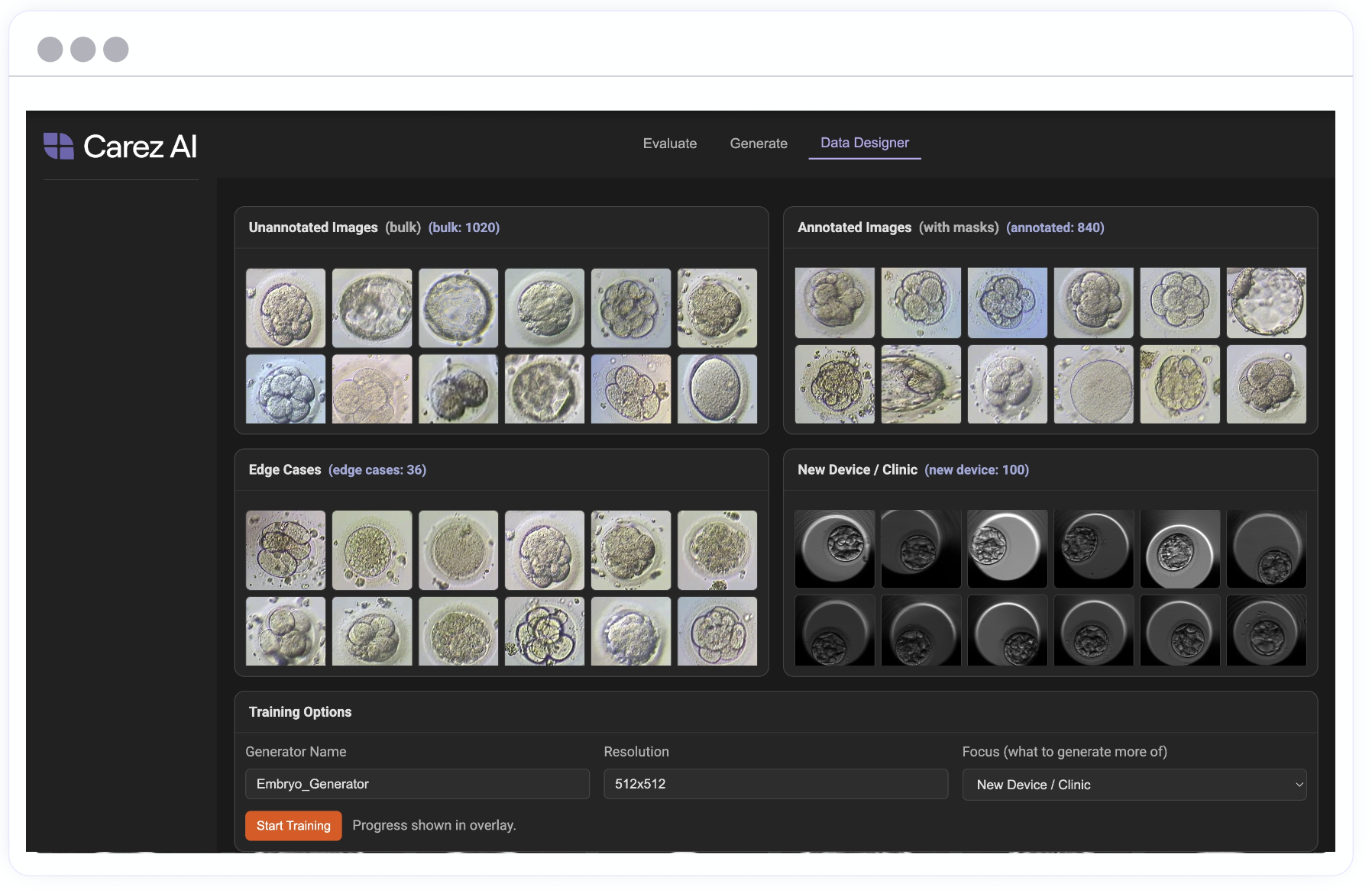 Carez AI data designer interface with annotated and unannotated medical image datasets